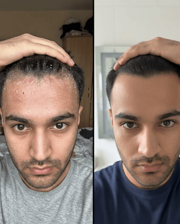 Daniyal Haider transformation
