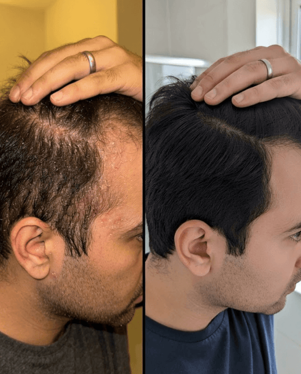 Shahzain Aslam transformation