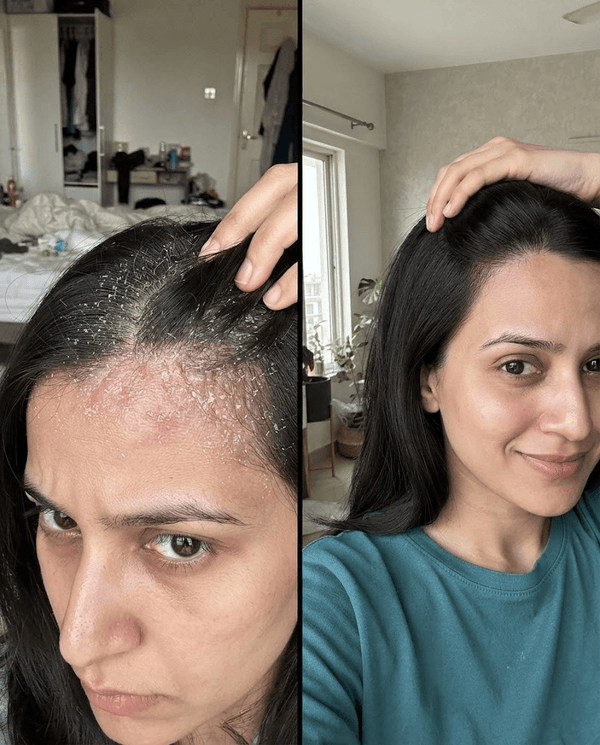 Anaya Qureshi transformation