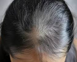 Weak Hair Growth