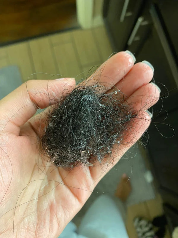 Excessive Hair Fall